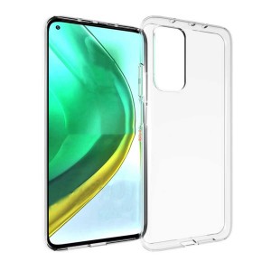 Nettech Xiaomi Mi 10T Uyumlu Lüx Seri Arka Koruma Kılıf (Şeffaf) NT-83655