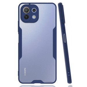 Nettech Xiaomi Mi 11 Lite Uyumlu Platin Seri Arka Koruma Kılıf (Lacivert) NT-86528